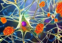 Риск болезней Паркинсона и Альцгеймера после вирусных инфекций?