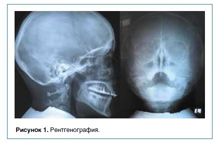 Современные методы диагностики в ринологии