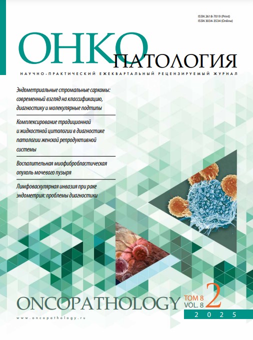 Онкопатология № 2, 2025 год № 2, 2025 год