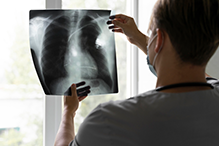 Курение — ведущий модифицируемый фактор риска рака легкого для пациентов старше 50 лет