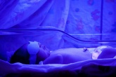 Быстрый метод выявления желтухи у новорожденных разработали австралийские ученые