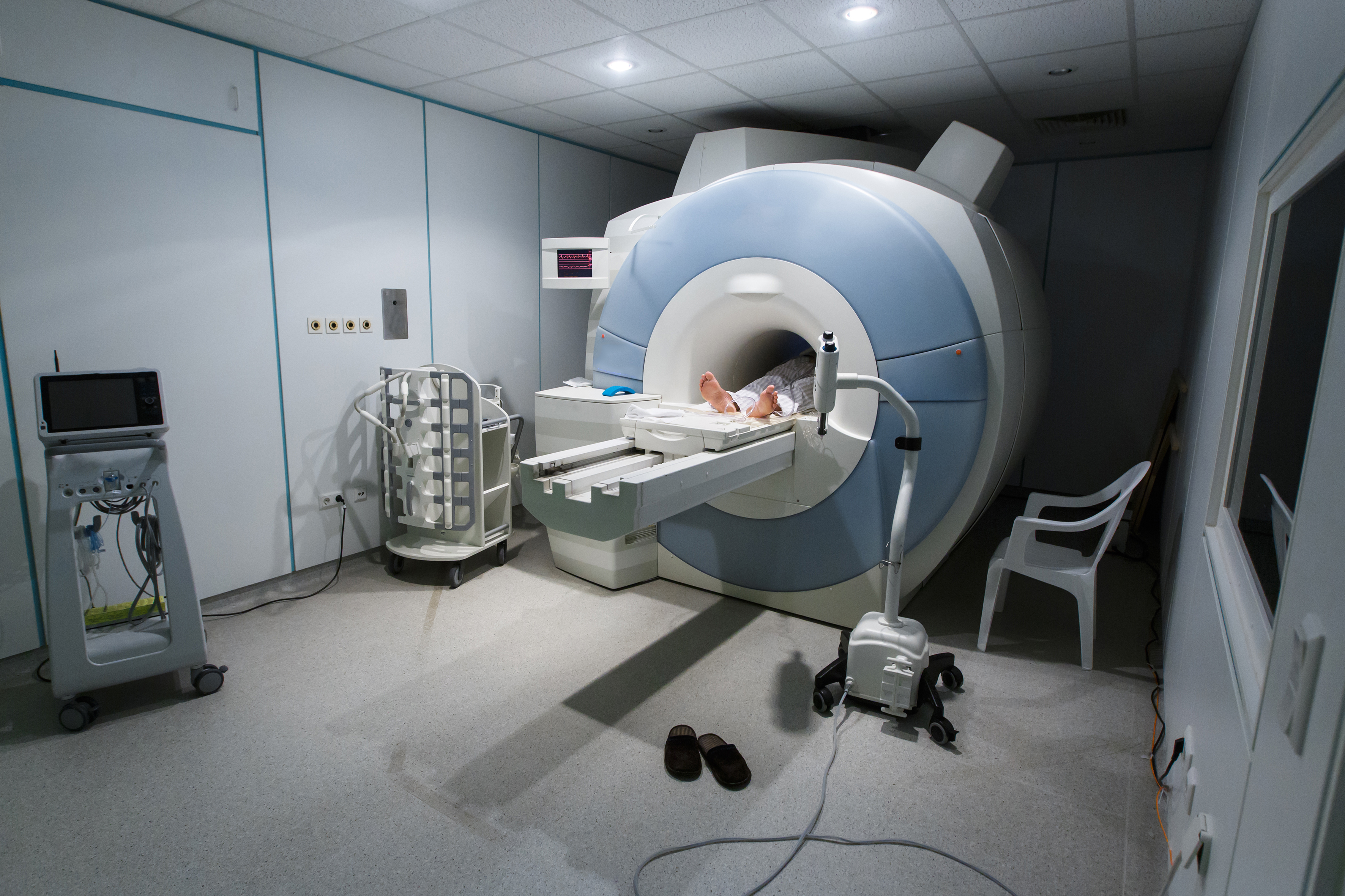 МРТ с машинным обучением предскажет исход травмы головного мозга