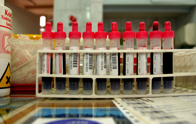Анализ крови определит чувствительность в новому противоопухолевому препарату