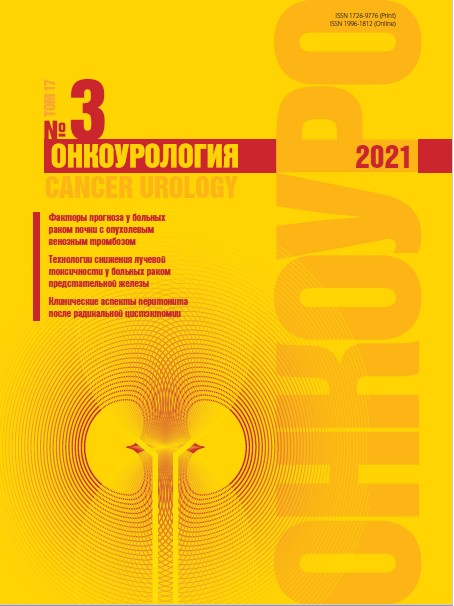 Онкоурология № 3, 2021 год  № 3, 2021 год