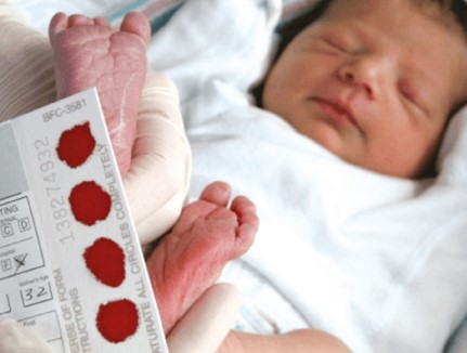 Заподозрить поломку в генах можно уже в первую неделю жизни ребенка