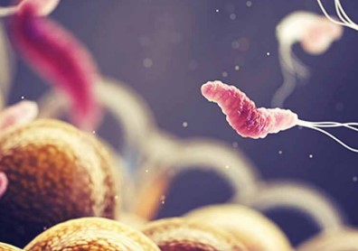 Хронический гастрит, ассоциированный с Helicobacter pylori