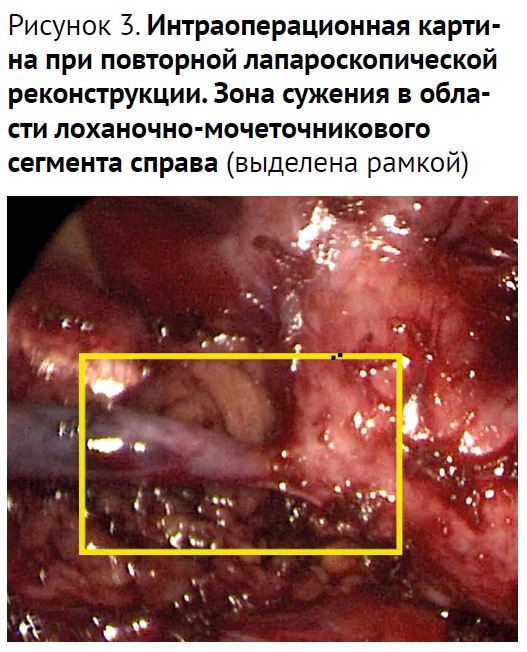 ПС 6-26-23.JPG
