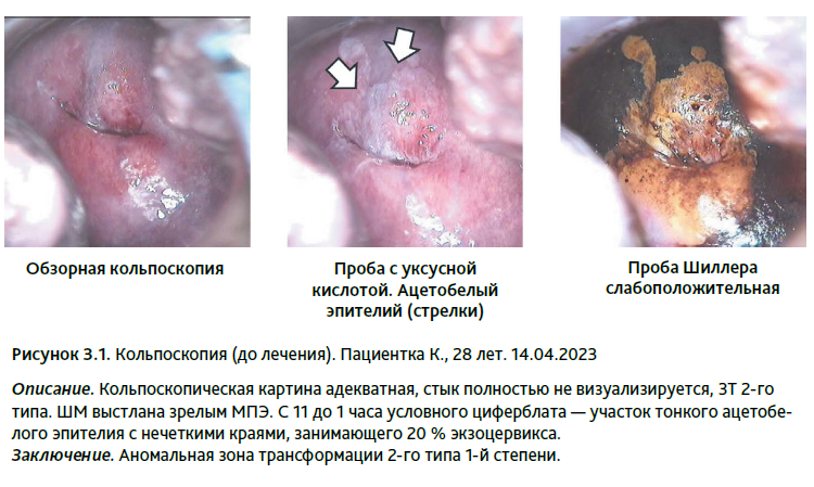 Атлас кольпоскопии – принципы и практика