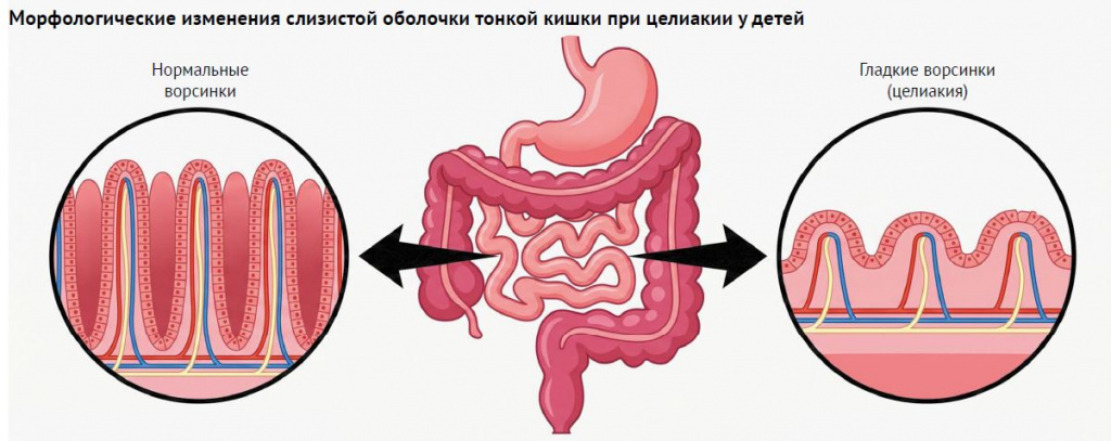 ПС 6-26-15.JPG