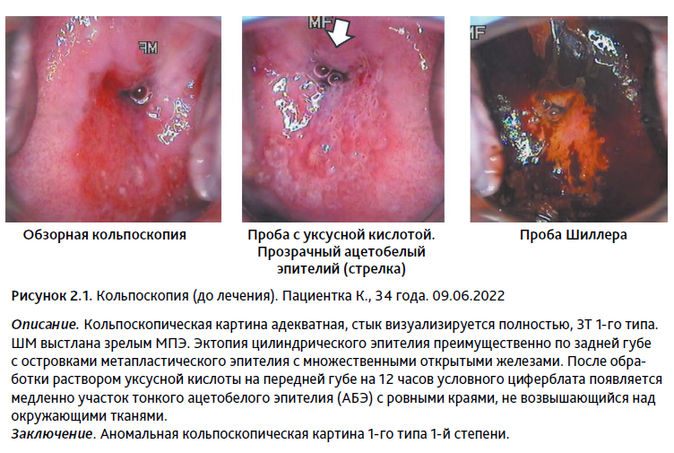 Цитологическое исследование