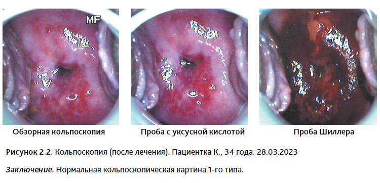 АГС 2-24-25.PNG